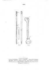 Устройство для внутрикостного остеосинтеза (патент 186082)
