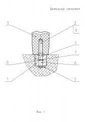 Дентальный имплантат (патент 2624173)