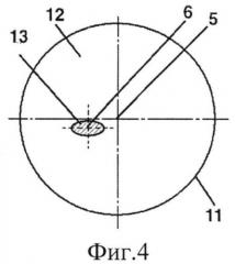 Способ хирургической коррекции сложного неправильного миопического роговичного астигматизма (патент 2548518)