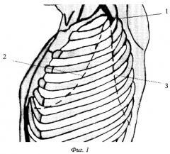 Способ выбора мини-доступа к органам грудной клетки (патент 2254070)