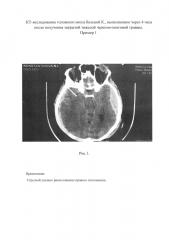 Способ оценки риска развития сепсиса у больных с тяжелой черепно-мозговой травмой (патент 2624171)