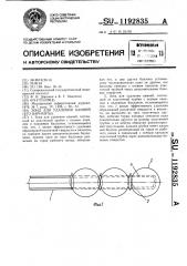 Зонд для удаления камней (его варианты) (патент 1192835)