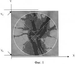 Способ диагностики новообразований зрительного нерва (патент 2553511)