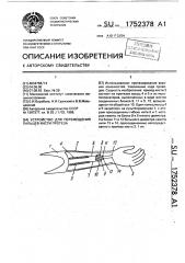 Устройство для перемещения пальцев кисти протеза (патент 1752378)