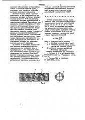 Протез кровеносного сосуда (патент 995777)