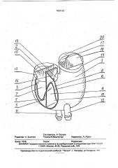 Искусственный желудочек сердца (патент 1803132)