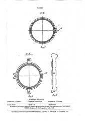 Устройство жеребного для создания компрессии при лечении переломов в гипсовых повязках (патент 1616652)
