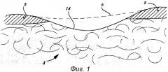 Система in-situ для внутриартикулярной регенерации хрящевой и костной тканей (патент 2451527)
