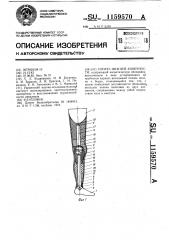 Протез нижней конечности (патент 1159570)