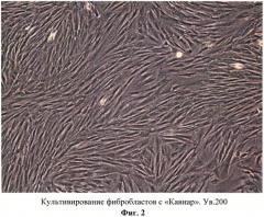 Способ выделения фибробластов, способ создания биотрансплантата на их основе (варианты) и способ регенерации тканей человека (варианты) (патент 2567004)
