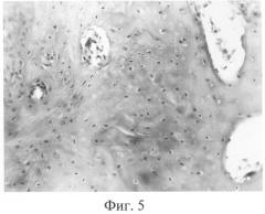 Способ камерной стерилизации биологических трансплантатов низкотемпературной плазмой пероксида водорода (патент 2317109)