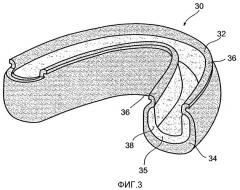 Ионообменное стоматологическое устройство и способ (патент 2363416)