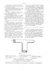 Протез гортани и трахеи (патент 1405832)