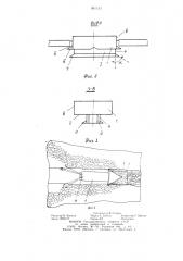 Ледоочистительная приставка судна (патент 901153)