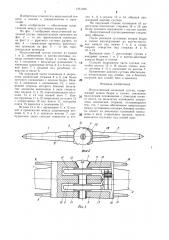 Искусственный коленный сустав конструкции р.в.никогосяна и ш.б.ахмедова (патент 1351598)
