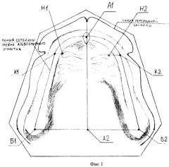 Способ диагностики атрофии беззубых челюстей (патент 2459595)