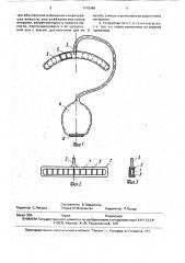Устройство для вакуумного самомассажа (патент 1715348)