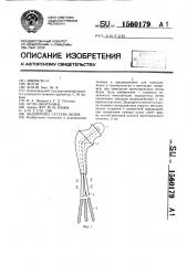 Эндопротез сустава бедер (патент 1560179)