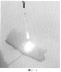 Способ лазерной сварки биологических тканей (патент 2425700)