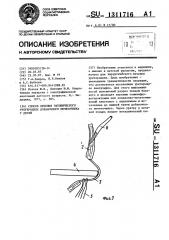 Способ лечения эктопического уретероцеле добавочного мочеточника у детей (патент 1311716)