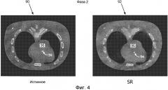 Реконструкция из разреженных данных для стробированной рентгеновской ст-визуализации (патент 2568835)