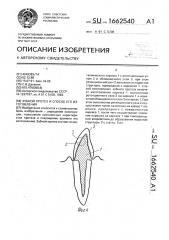 Зубной протез и способ его изготовления (патент 1662540)