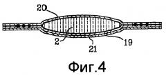 Адсорбирующее изделие (патент 2375031)