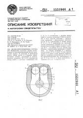 Цилиндропоршневая группа (патент 1551944)