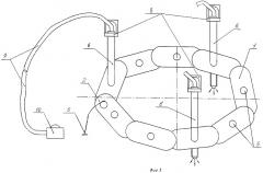 Подъемник передней брюшной стенки с осветителем (патент 2279256)