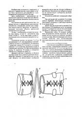 Устройство для разработки лучезапястного сустава (патент 1667859)