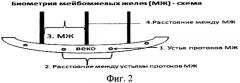 Способ оценки морфофункционального состояния мейбомиевых желез - биометрия мейбомиевых желез (патент 2567829)