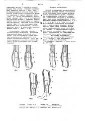 Способ изготовления косметической об-лицовки протеза нижних конечностей (патент 806026)