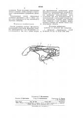 Способ удлинения костных фрагментов (патент 827035)