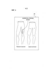 Ангиосомная система контроля кровоснабжения (патент 2587949)