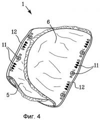 Абсорбирующее изделие (патент 2261079)