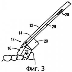 Прилегающая к зубам головка зубной щетки (варианты) (патент 2286705)