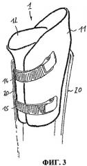 Приемная гильза протеза и система из приемной гильзы протеза и протезного устройства (патент 2476190)
