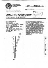 Зонд для энтерального питания (патент 1042755)