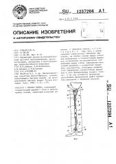 Протез бедра (патент 1237204)