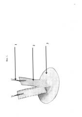 Способ миниинвазивной лапароскопической паховой герниопластики с трасгерниальной фиксацией избирательно адгезивного аллотрасплантата (патент 2580974)