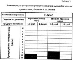 Способ диагностики клинически актуальных мышечно-сухожильных меридианов (патент 2477977)