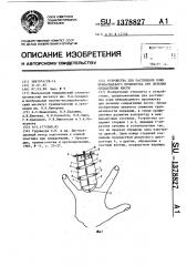 Устройство для растяжения кожи межпальцевого промежутка при лечении синдактилии кисти (патент 1378827)
