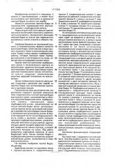 Крепление протеза бедра (патент 1777856)
