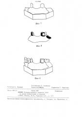 Способ обработки зубов перед протезированием (патент 1247006)