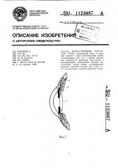 Искусственный хрусталик глаза (патент 1123687)