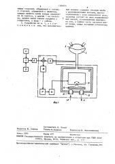 Устройство управления протезом сердца (патент 1584954)