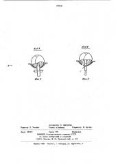 Устройство для очистки кочанов капусты (патент 978820)