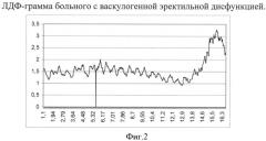 Способ диагностики васкулогенной эректильной дисфункции (патент 2511078)