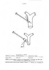 Пункционная игла (патент 1475619)