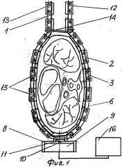 Кардиомассажер (патент 2245705)